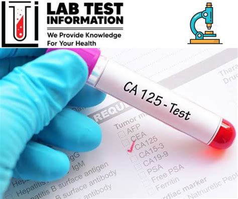 ca 125 blood test bottle|when to check ca 125.